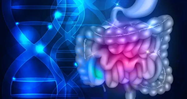 Kalın Bağırsak Kanserinde Ciddi Risk Faktörü: Kalıtım
