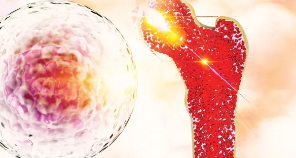 Çocuklarda Hematopoietik Kök Hücre / Kemik İliği Nakli Nedir?