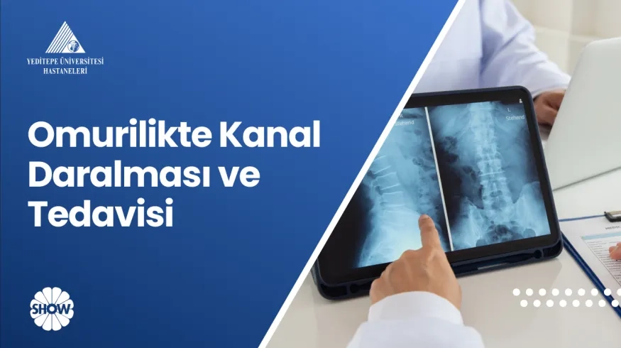 Omurilikte Kanal Daralması ve Tedavisi | Prof. Dr. Ahmet Hilmi Kaya