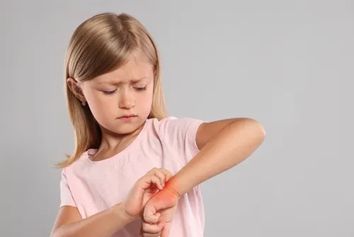 What is Molluscum Contagiosum? What are the Symptoms?