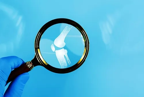 Kalça Eklemi Hastalıkları Nelerdir? Nedenleri ve Tedavisi