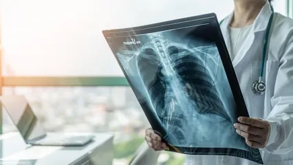 Sırt Ağrısı Akciğer Kanseri Belirtisi Olabilir mi?