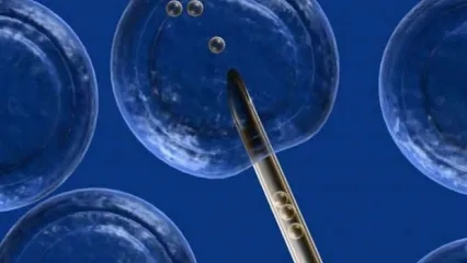 Embriyo Transferinde Dikkat Edilmesi Gerekenler