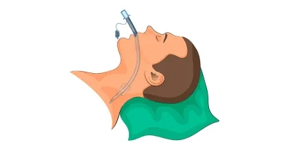 Entübe Etmek Nedir?