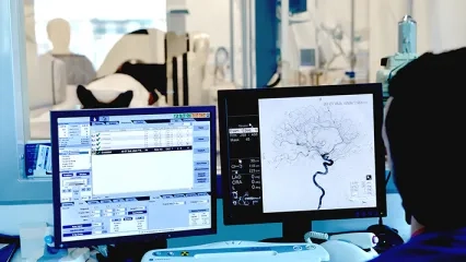  Diagnosis and Treatment of Acute Stroke