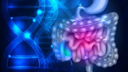 Kalın Bağırsak Kanserinde Ciddi Risk Faktörü: Kalıtım
