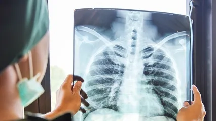 Zatürre Aşısının Yan Etkileri Kaç Gün Sürer?