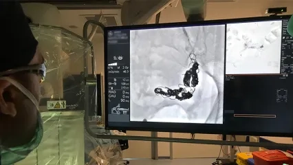 Intravenous Pyelography (IVP)