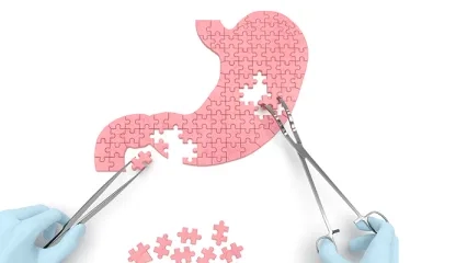 Obezite Ameliyatları Riskli Midir?