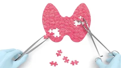 Tiroid Cerrahisi (Ameliyatları)