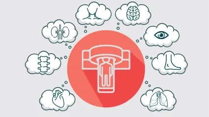 Nükleer Tıp Tanı ve Tedavi