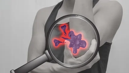 Kemik ve Yumuşak Doku Tümörleri Biyopsisi