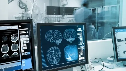 Don’t Risk Your Brain!