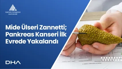 Thought Stomach Ulcer; Pancreatic Cancer Caught in the First Stage