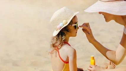 Güneş Yanığı Görsel