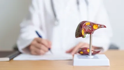 What is Cirrhosis? What Causes Cirrhosis