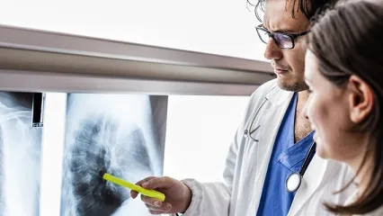 Lung Cancer Screening Age