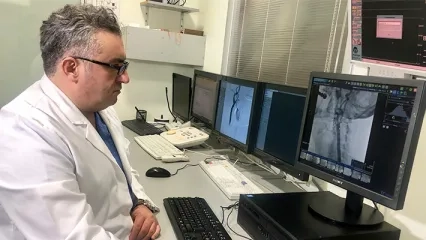 Carotid Artery Disease