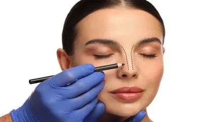Nose Aesthetic Surgery - What You Need to Know