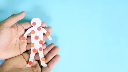 What is Measles? Symptoms and Treatment