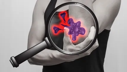 What is a Bone Tumor? Bone Tumor Symptoms