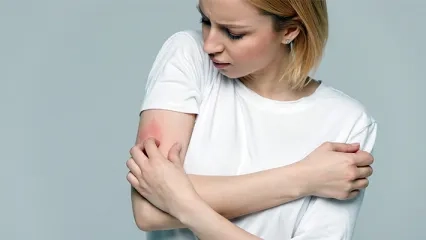 What is Shingles? Shingles Symptoms and Treatment