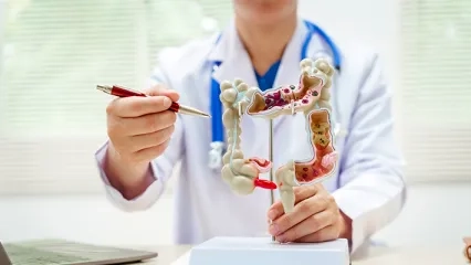 Kolon Kanseri Kimlerde Görülür?