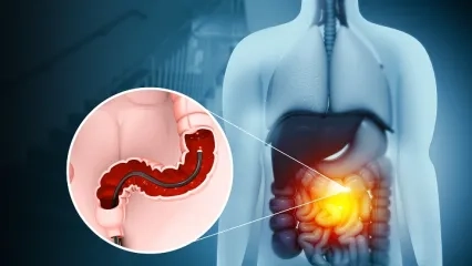 Kolonoskopi Nedir? Nasıl Yapılır?