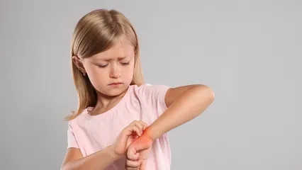 What is Molluscum Contagiosum? What are the Symptoms?