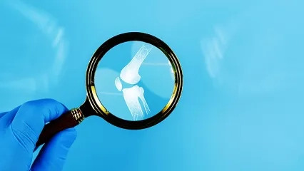 Kalça Eklemi Hastalıkları Nelerdir? Nedenleri ve Tedavisi