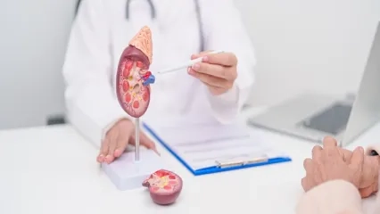 Intravenous Pyelography (IVP)