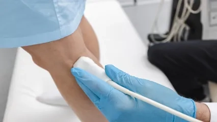 Ultrasound ve Doppler Ultrasonografi