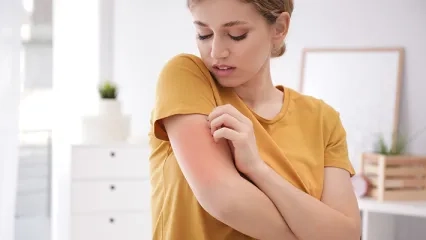 Why Do Mosquitoes Bite Some People More?