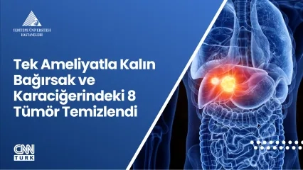 tek_ameliyatla_kalin_bagırsak_temizlendi