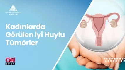 Kadınlarda İyi Huylu Tümörler ve Nedenleri