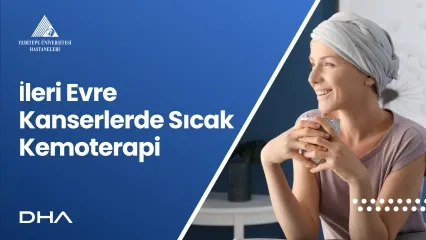 İleri Evre Kanserlerde Sıcak Kemoterapi 