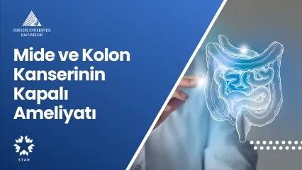 Mide ve Kolon Kanserinin Kapalı Ameliyatı 