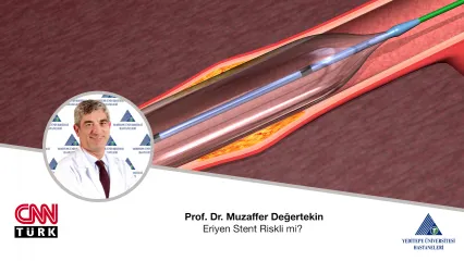 Eriyen Stent Riskli mi? | Prof. Dr. Muzaffer Değertekin