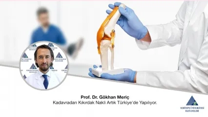 Kadavradan Kıkırdak Nakli Artık Türkiye’ de Yapılıyor | Prof. Dr. Gökhan Meriç