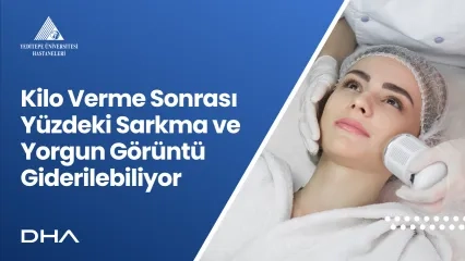 Kilo Verme Sonrası Yüzdeki Sarkma ve Yorgun Görüntü Giderilebiliyor | Doç. Dr. Osman Kelahmetoğlu