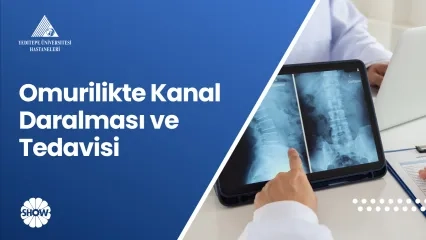 Omurilikte Kanal Daralması ve Tedavisi | Prof. Dr. Ahmet Hilmi Kaya