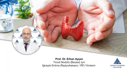 Tiroid Nodülü (Bezesi) için İğneyle Eritme (Radyofrekans / RF) Yöntemi 