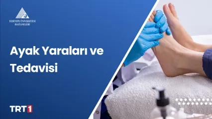 Ayak Yaraları ve Tedavisi
