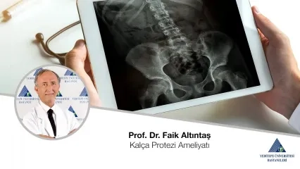 Kalça Protezi Ameliyatı | Prof. Dr. Faik Altıntaş