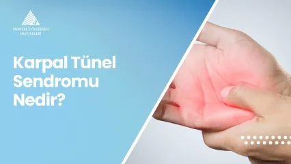 Karpal Tünel Sendromu ve Tedavisi