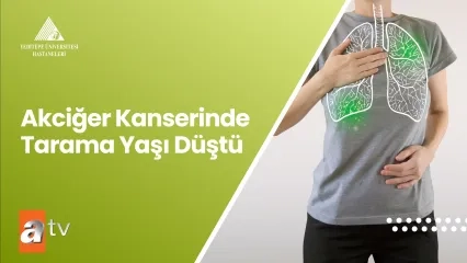 Akciğer Kanserinde Tarama Yaşı Düştü 