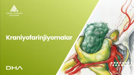 Kraniyofarinjiyomalar  |  Prof. Dr. Fahrettin Keleştemur, Prof. Dr. Uğur Türe