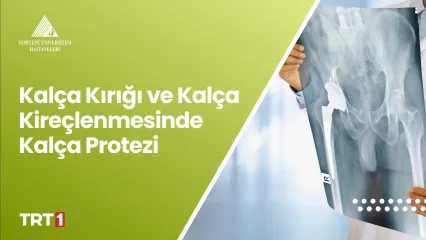 Kalça Kırığı ve Kalça Kireçlenmesinde Kalça Protezi