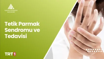 Tetik Parmak Sendromu ve Tedavisi