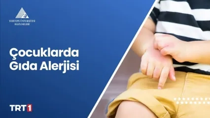 Çocuklarda Gıda Alerjisi 